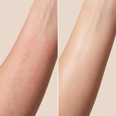 Hyalura Hypochlorous Acid Facial Spray – Calming Rice Water Exfoliant (80ml)